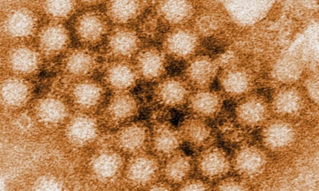 मिनेसोटा में नॉरोवायरस के मामलों में रिकॉर्ड बढ़ोतरी, सर्दी में प्रकोप चरम पर norovirus - Hindi News Express